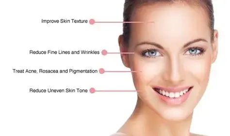 Improving skin texture and tone Improving skin texture and tone