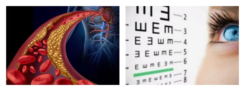 Ginkgo Biloba Extract Function Ginkgo Biloba Extract Function