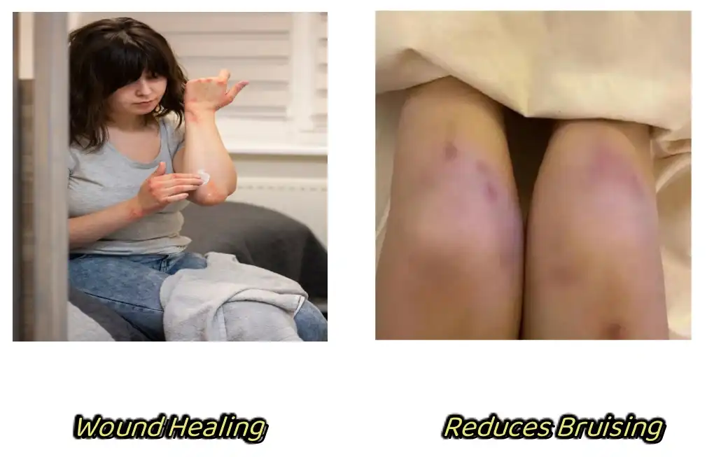 Hyaluronidase Powder Functions Hyaluronidase Powder Functions