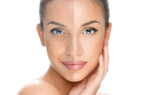 Sakura for Skin-Lighting up Sakura for Skin-Lighting up