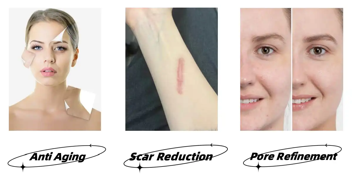 Spongilla Spicule Functions Spongilla Spicule Functions