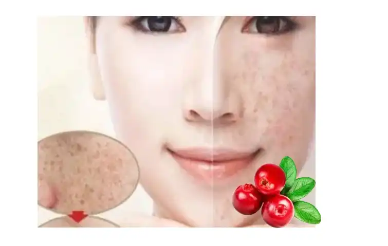 Alpha Arbutin Powder for Skin Brightening Alpha Arbutin Powder for Skin Brightening