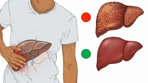 Liver Health Liver Health