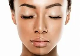 Deoxyarbutin Powder for Skin Lighteners Deoxyarbutin Powder for Skin Lighteners