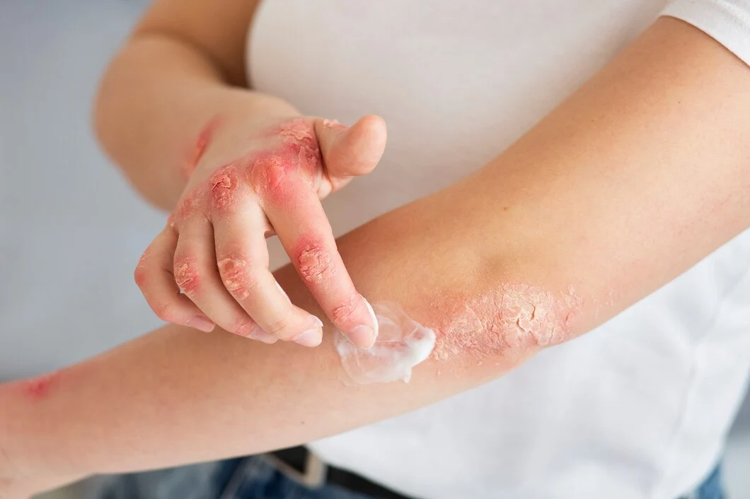 Wound Healing