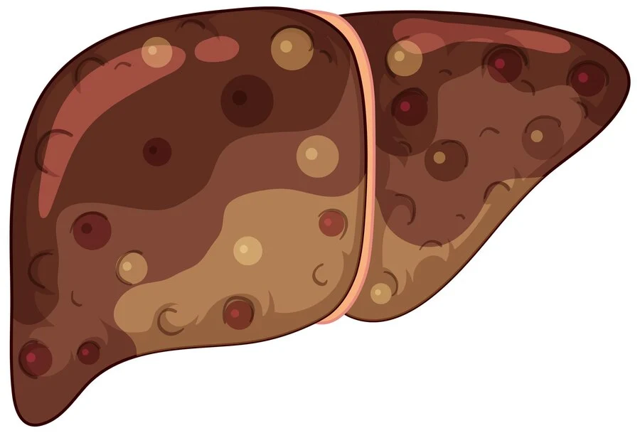 Phellodendron Extract for Liver