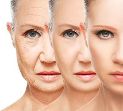 Aronia Extract Powder for Anti-Aging