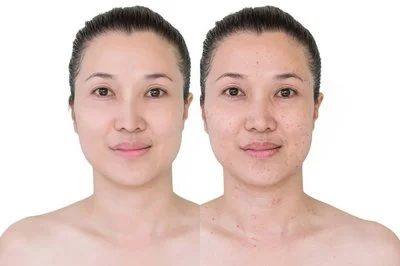 Anti-Aging