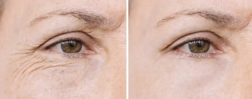 Yak Bone Marrow Peptide Yak Bone Marrow Peptide