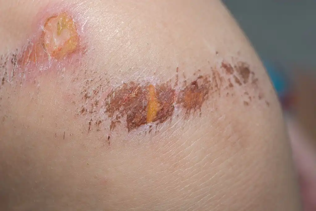 glutamine peptide 2 glutamine peptide 2