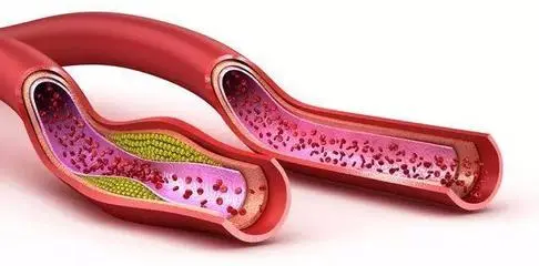 Reduce blood lipids